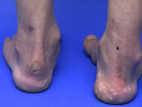 Pieds vérins inox main image 1
